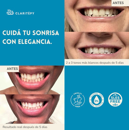 Tiras Blanqueadoras Dentales – Sonrisa Perfecta en Minutos